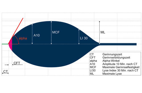 Messergebnis als Grafik